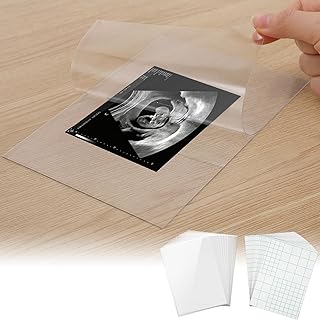 20 Sets User-Friendly Laminating Sheets for 3x4/4x6in Ultrasound Pictures- Keep Baby Sonogram Picture/Special Memories Safe, Pregnancy Journal Must Haves, Pregnancy Gifts for Expecting Mom
