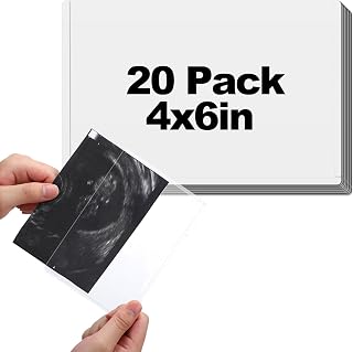 Easy Insert Photo Protector for 4x6in Ultrasound Pictures - Side-Loading to Keep Baby Sonogram Picture/Special Memories Safe, Pregnancy Journal Must Haves, Pregnancy Gifts for Expecting Mom, 20 Pack